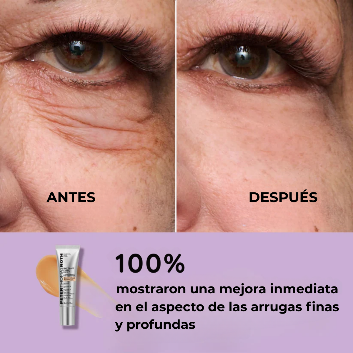 DermaLise Alisador Instantáneo para el Contorno de Ojos