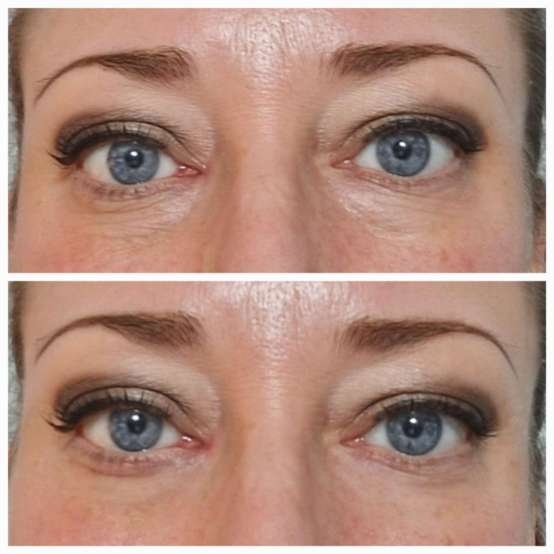 DermaLise Alisador Instantáneo para el Contorno de Ojos