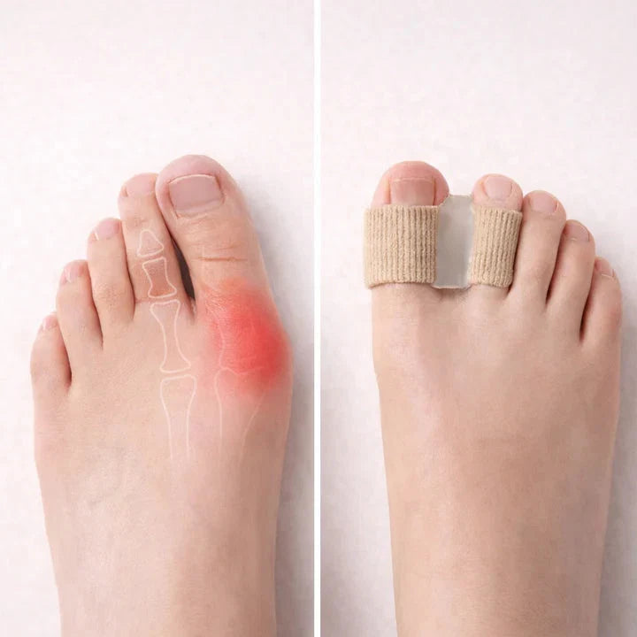 Separador de Dedos de Gel Reutilizable para Hallux Valgus 1 Par