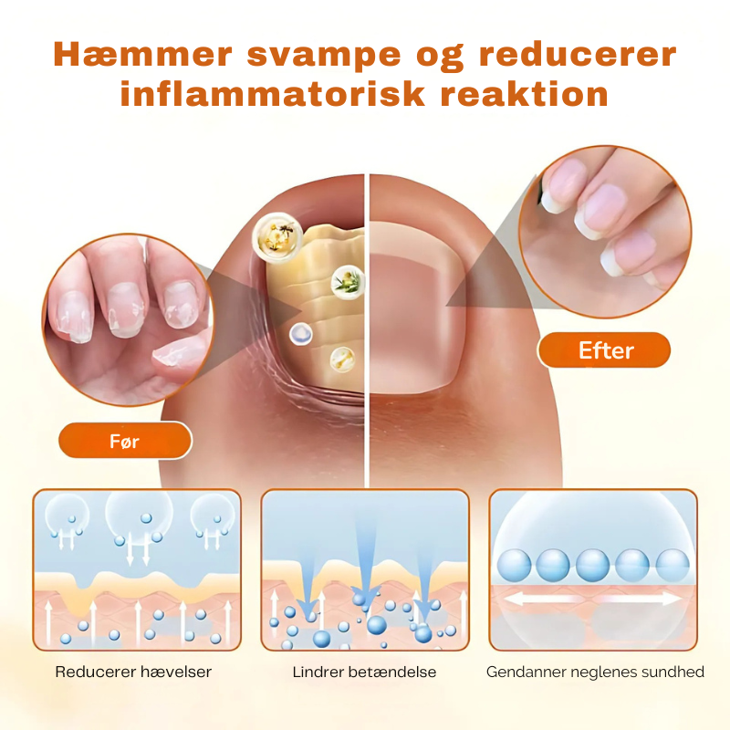 FungiStop – Spray de Cuidado de Uñas Antifúngico Avanzado