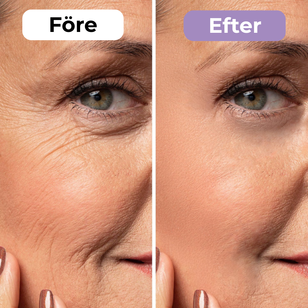 SilkoLapp™ - Protección suave para una piel más suave