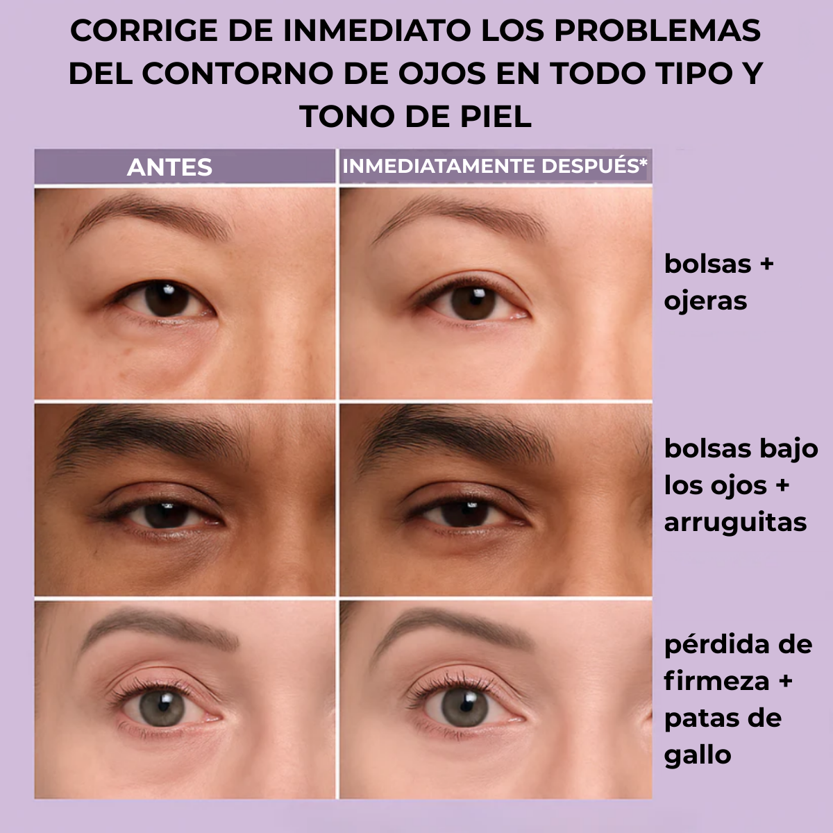 DermaLise Alisador Instantáneo para el Contorno de Ojos