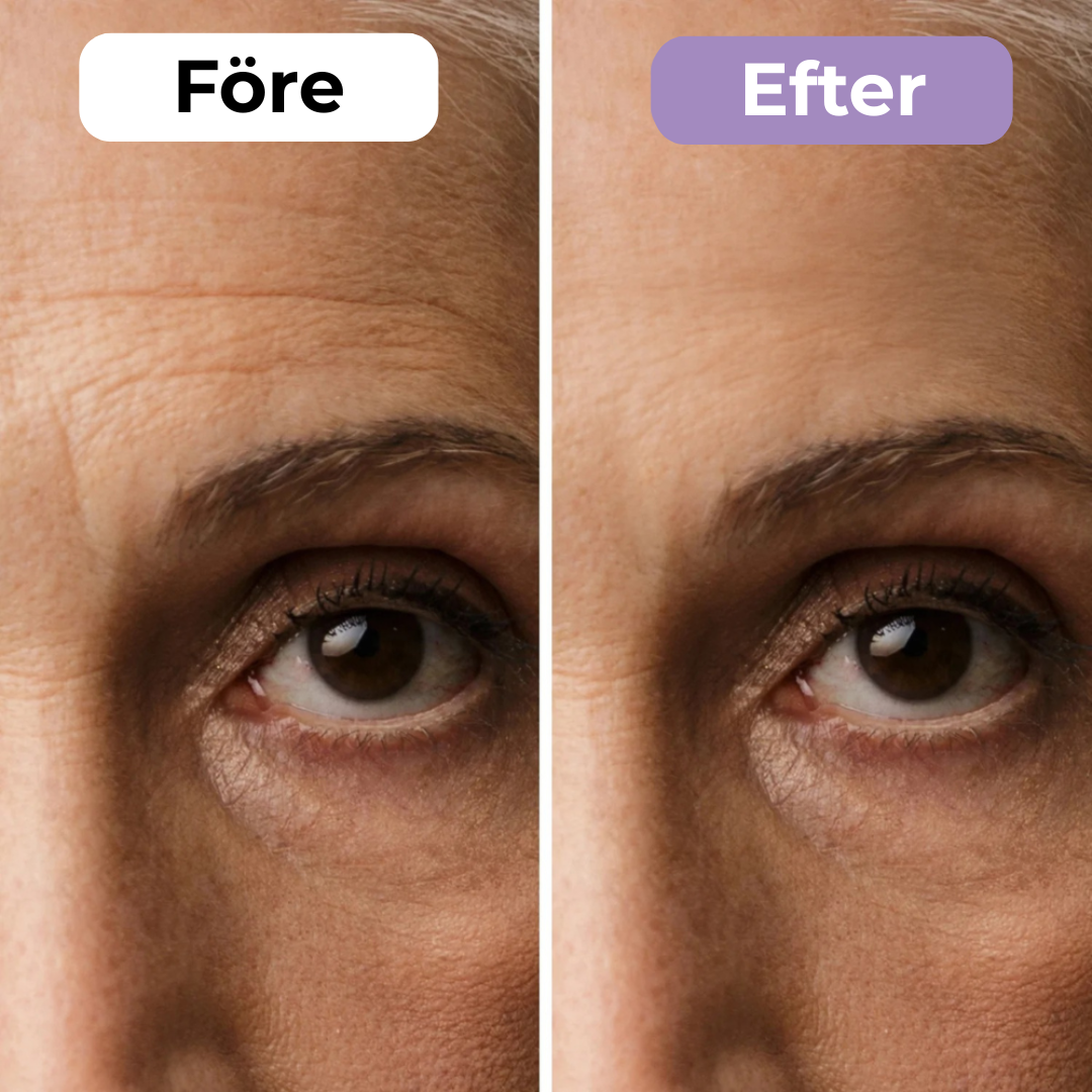 SilkoLapp™ - Protección suave para una piel más suave