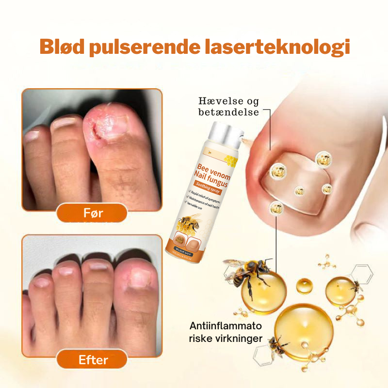 FungiStop – Spray de Cuidado de Uñas Antifúngico Avanzado